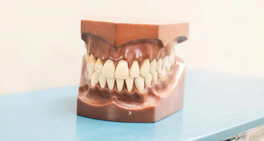 Um grande plano de um modelo dentário que mostra um conjunto de dentes retos.