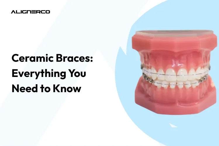 Aparelho cerâmico em modelo de dente