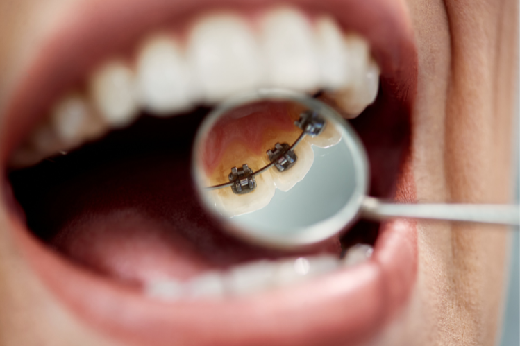 Uma mulher sorridente com uma classe que eu mordo.