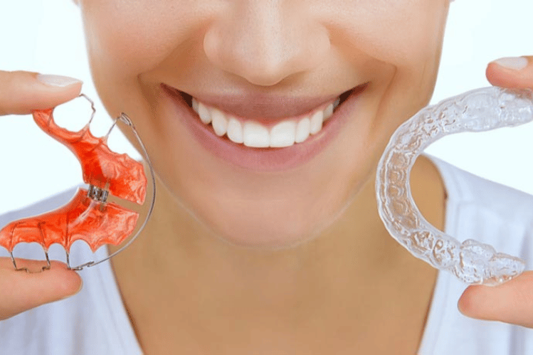 Você consegue uma contenção fixa após o tratamento com alinhadores transparentes?