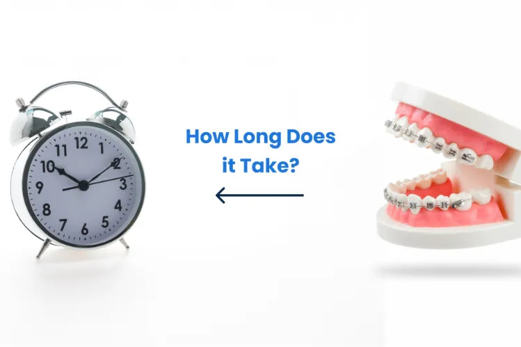 ortodôntico alinhar os dentes