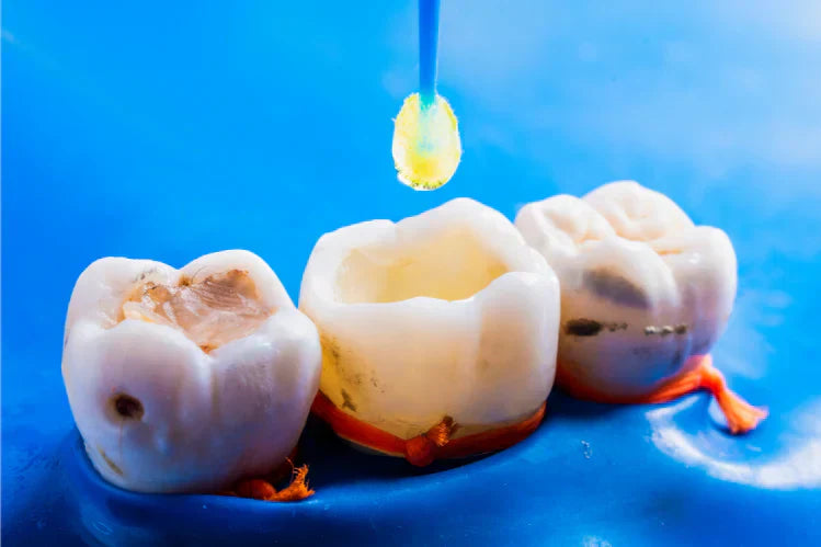 obturação dentária num dente