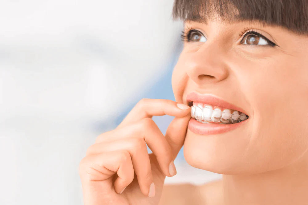 A case study of retroclined upper anteriors & anterior open bite ALIGNERCO Clear Aligners