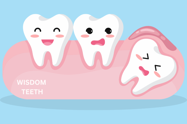 Posso usar os meus alinhadores com os meus dentes do siso?